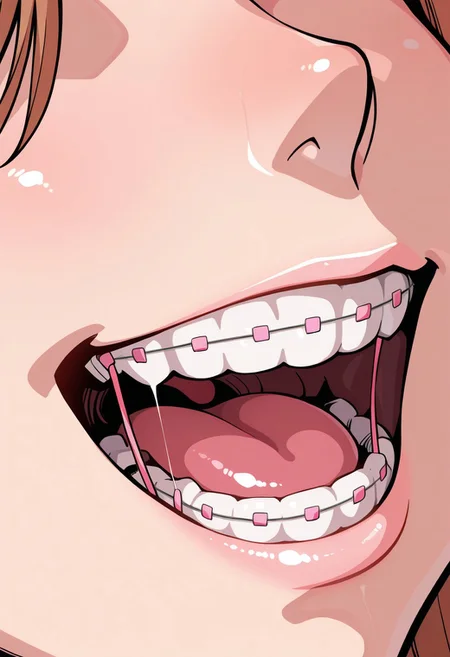 masterpiece,best quality,amazing quality,
close-up,
mouth, teeth, braces, teeth braces, t3kuh0_br4c3s, close-up, solo, 1girl, pink braces